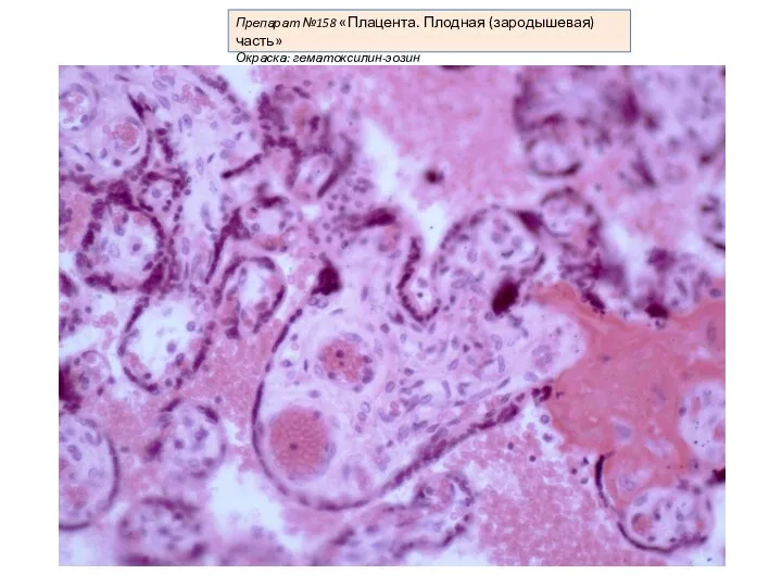 Препарат №158 «Плацента. Плодная (зародышевая) часть» Окраска: гематоксилин-эозин