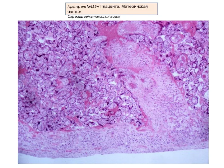 Препарат №159 «Плацента. Материнская часть» Окраска: гематоксилин-эозин