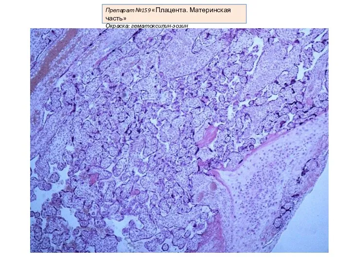 Препарат №159 «Плацента. Материнская часть» Окраска: гематоксилин-эозин