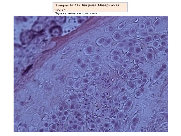 Препарат №159 «Плацента. Материнская часть» Окраска: гематоксилин-эозин