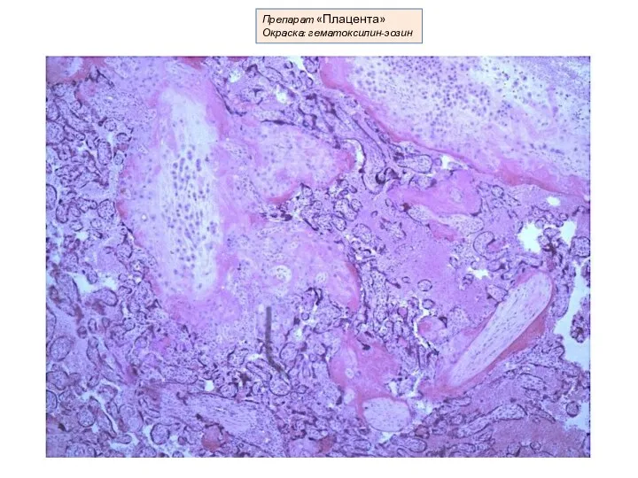 Препарат «Плацента» Окраска: гематоксилин-эозин