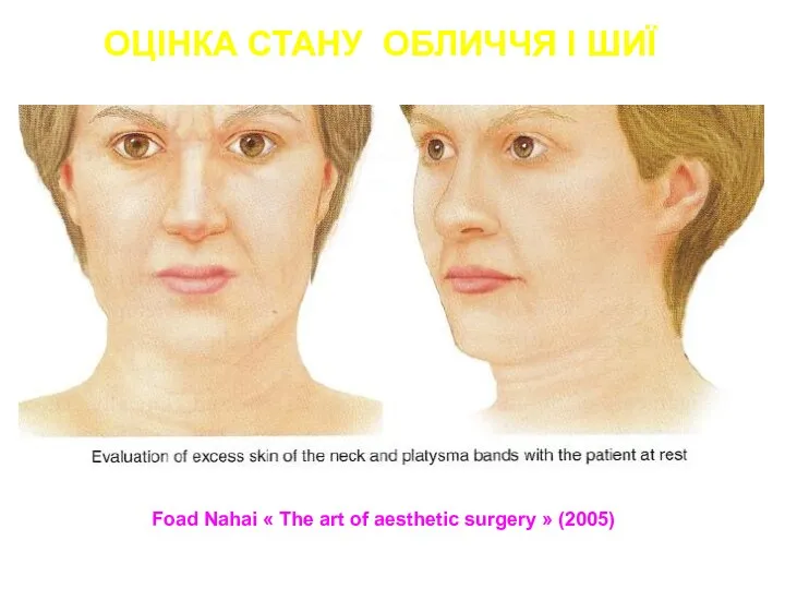 Foad Nahai « The art of aesthetic surgery » (2005) ОЦІНКА СТАНУ ОБЛИЧЧЯ І ШИЇ