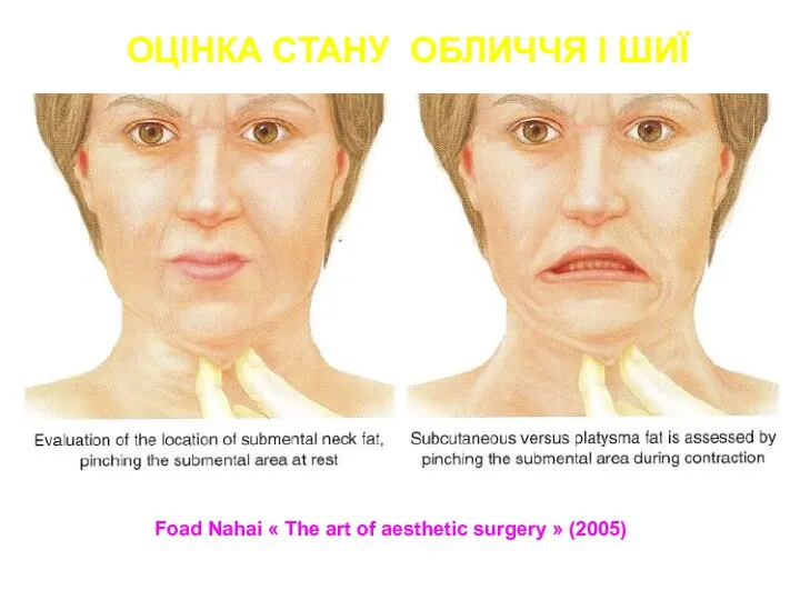 Foad Nahai « The art of aesthetic surgery » (2005) ОЦІНКА СТАНУ ОБЛИЧЧЯ І ШИЇ