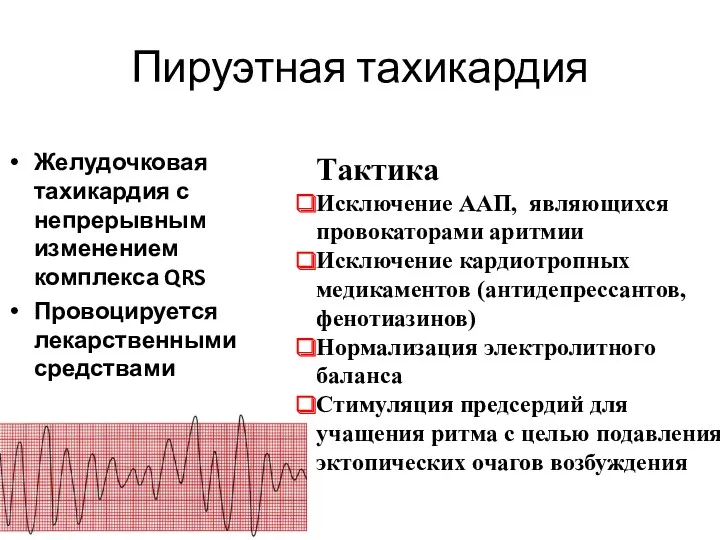 Пируэтная тахикардия Желудочковая тахикардия с непрерывным изменением комплекса QRS Провоцируется