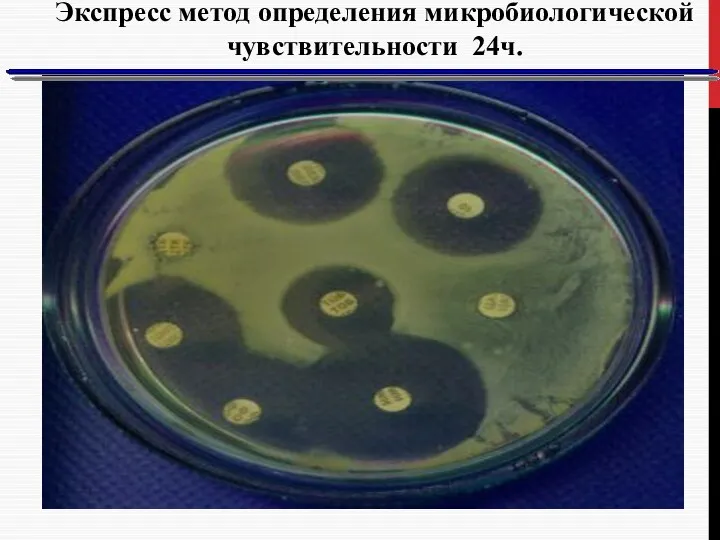 Экспресс метод определения микробиологической чувствительности 24ч.