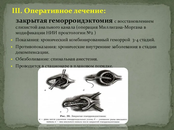 III. Оперативное лечение: закрытая геморроидэктомия с восстановлением слизистой анального канала