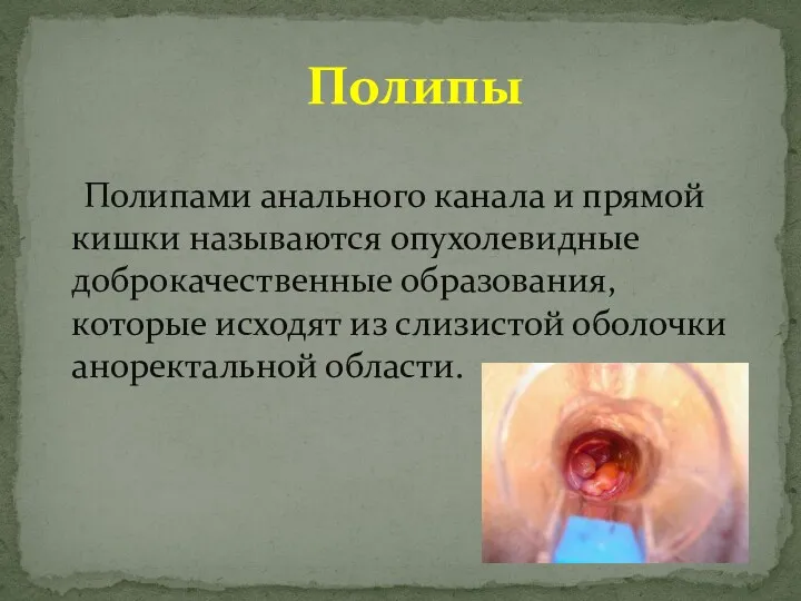 Полипами анального канала и прямой кишки называются опухолевидные доброкачественные образования,