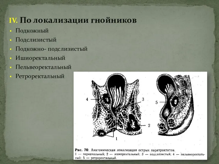 IV. По локализации гнойников Подкожный Подслизистый Подкожно- подслизистый Ишиоректальный Пельвеоректальный Ретроректальный