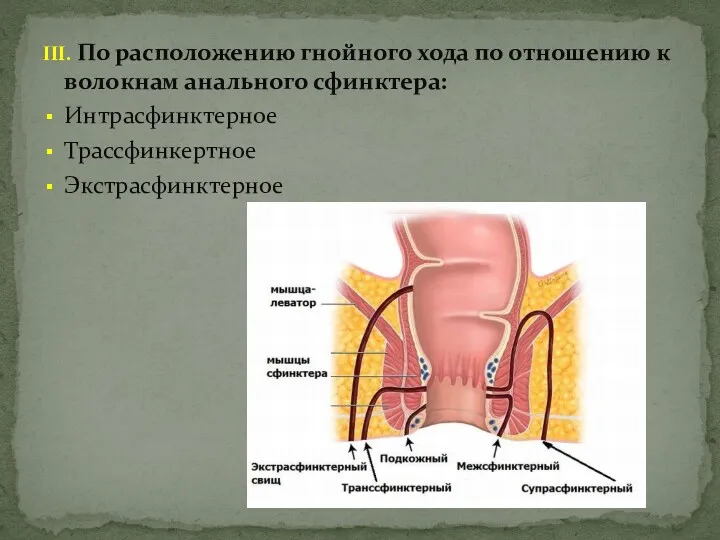 III. По расположению гнойного хода по отношению к волокнам анального сфинктера: Интрасфинктерное Трассфинкертное Экстрасфинктерное