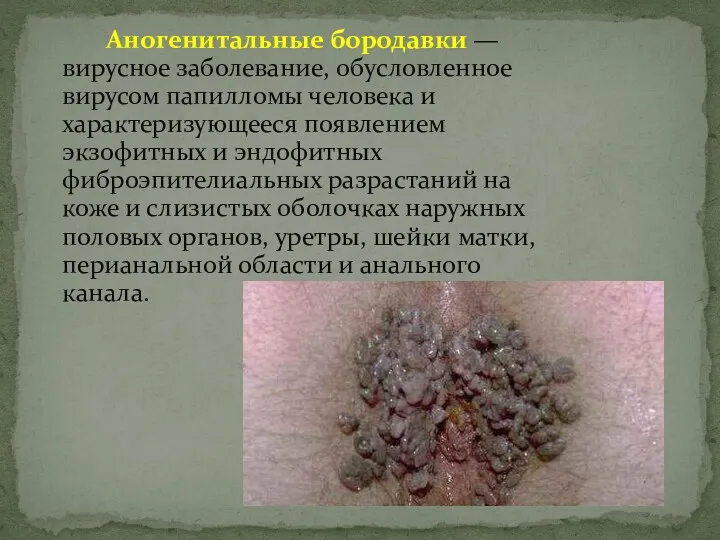 Аногенитальные бородавки — вирусное заболевание, обусловленное вирусом папилломы человека и характеризующееся появлением экзофитных