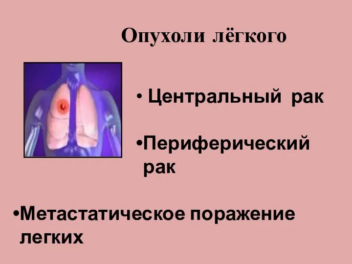 Опухоли лёгкого Центральный рак Периферический рак Метастатическое поражение легких