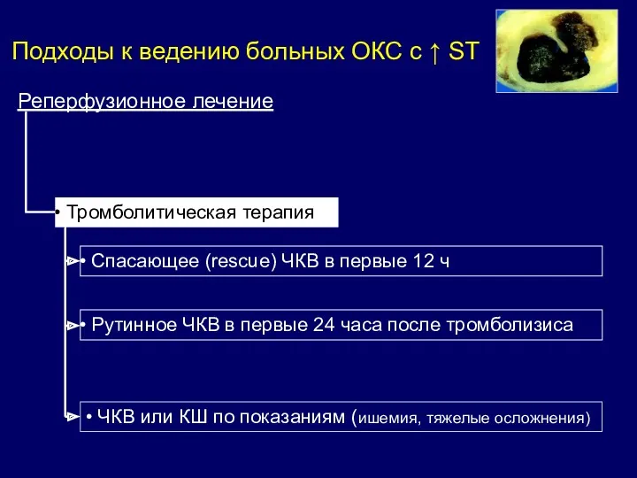 Реперфузионное лечение Тромболитическая терапия Спасающее (rescue) ЧКВ в первые 12 ч ЧКВ или