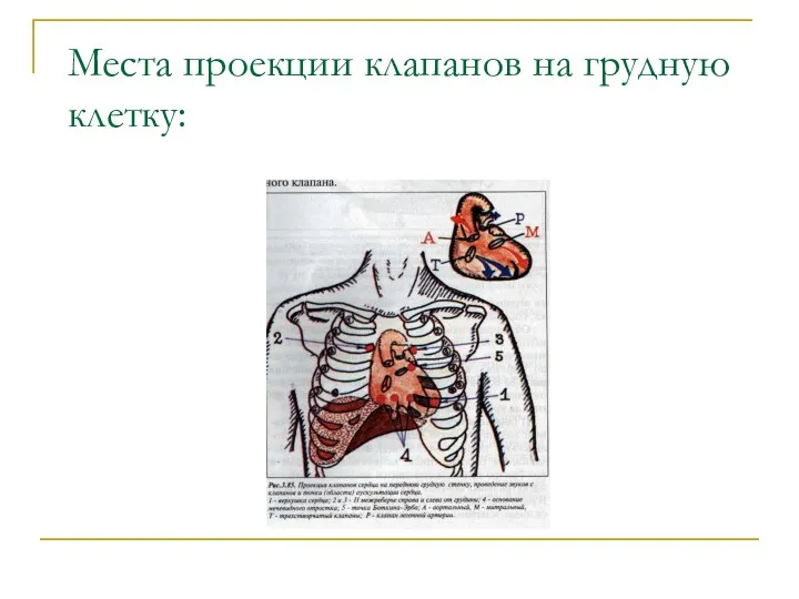 Места проекции клапанов на грудную клетку: