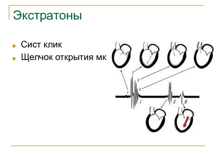 Экстратоны Сист клик Щелчок открытия мк