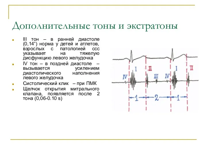 Дополнительные тоны и экстратоны III тон – в ранней диастоле