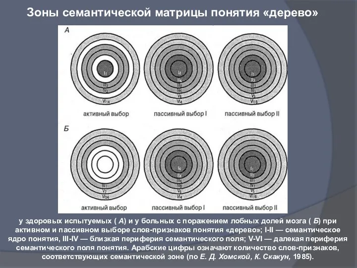 у здоровых испытуемых ( А) и у больных с поражением