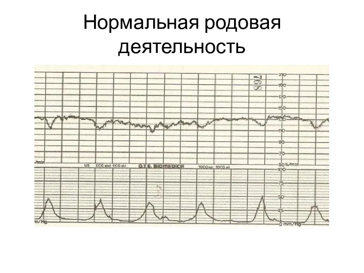 Нормальная родовая деятельность