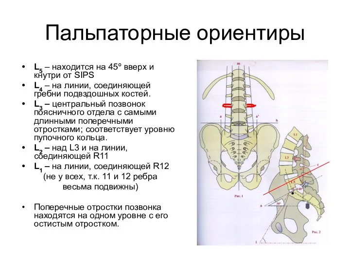 Пальпаторные ориентиры L5 – находится на 45º вверх и кнутри