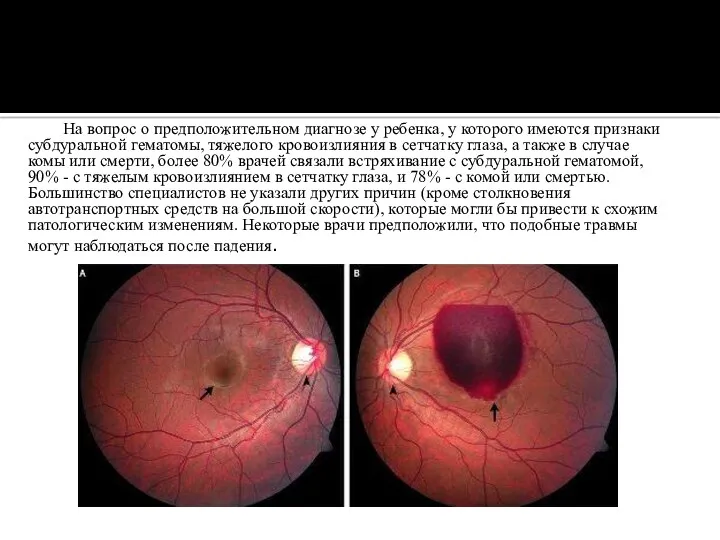 На вопрос о предположительном диагнозе у ребенка, у которого имеются