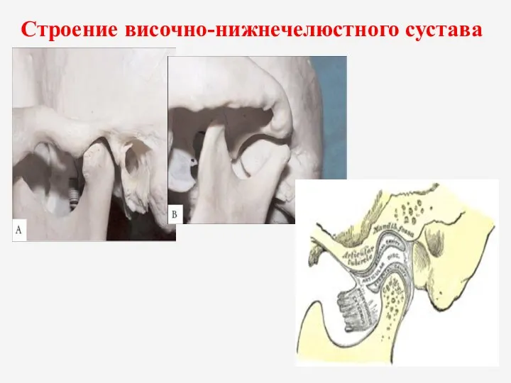 Строение височно-нижнечелюстного сустава