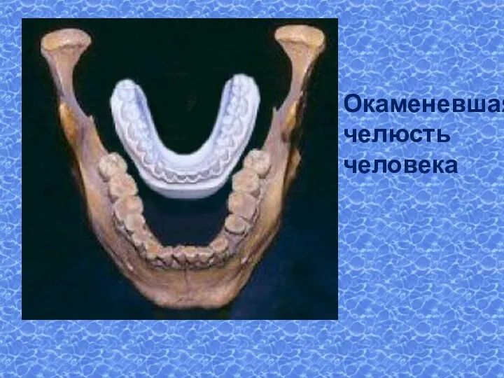 Окаменевшая челюсть человека