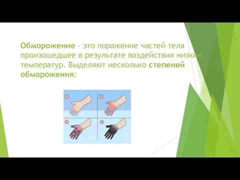 Обморожение – это поражение частей тела произошедшее в результате воздействия низких температур. Выделяют несколько степеней обморожения: