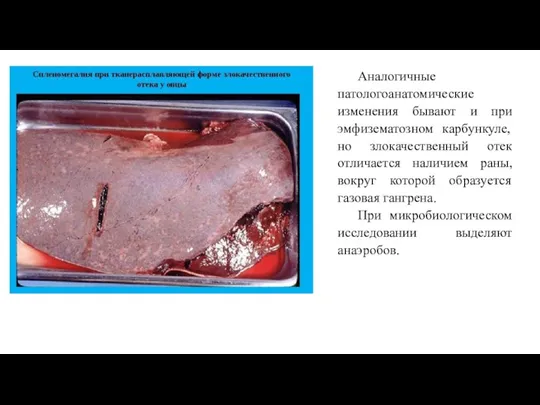 Аналогичные патологоанатомические изменения бывают и при эмфизематозном карбункуле, но злокачественный