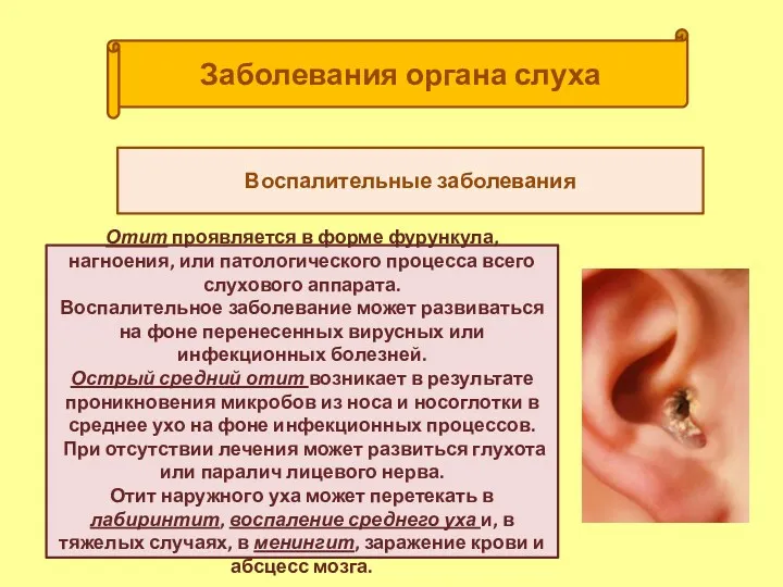 Заболевания органа слуха Воспалительные заболевания Отит проявляется в форме фурункула, нагноения, или патологического