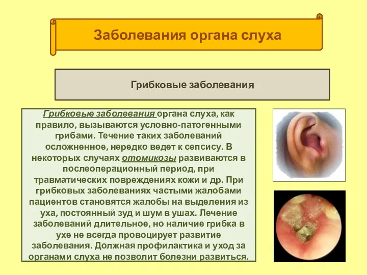 Заболевания органа слуха Грибковые заболевания Грибковые заболевания органа слуха, как правило, вызываются условно-патогенными