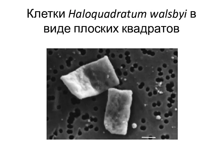 Клетки Haloquadratum walsbyi в виде плоских квадратов