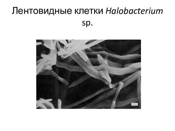 Лентовидные клетки Halobacterium sp.