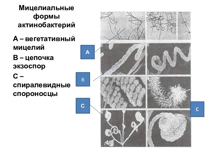 Мицелиальные формы актинобактерий А – вегетативный мицелий В – цепочка