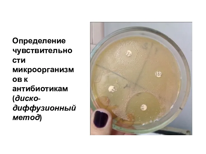 Определение чувствительности микроорганизмов к антибиотикам (диско-диффузионный метод)