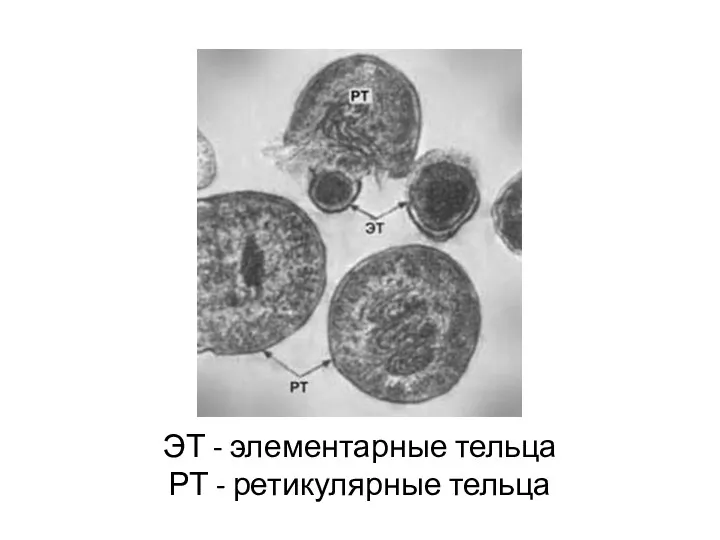 ЭТ - элементарные тельца РТ - ретикулярные тельца