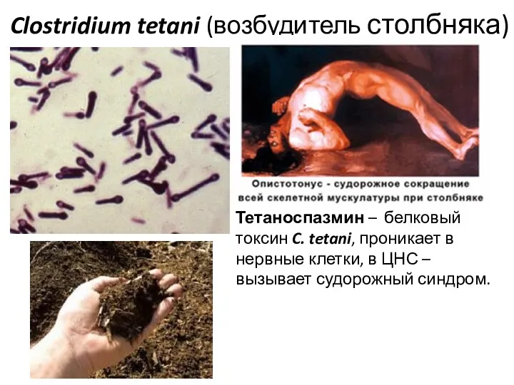 Clostridium tetani (возбудитель столбняка) Тетаноспазмин – белковый токсин C. tetani,
