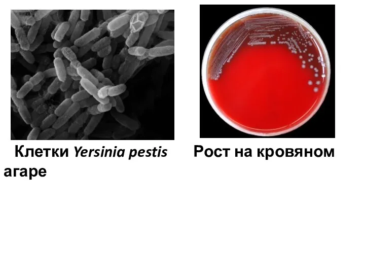 Клетки Yersinia pestis Рост на кровяном агаре