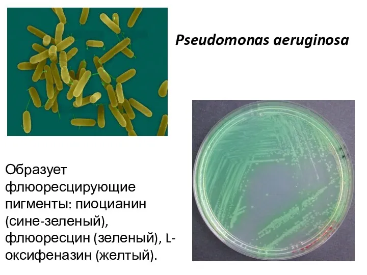 Pseudomonas aeruginosa Образует флюоресцирующие пигменты: пиоцианин (сине-зеленый), флюоресцин (зеленый), L-оксифеназин (желтый).