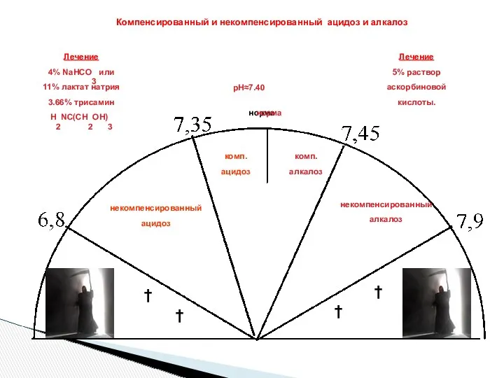 норма † † † † рН≈7.40 некомпенсированный ацидоз комп. ацидоз