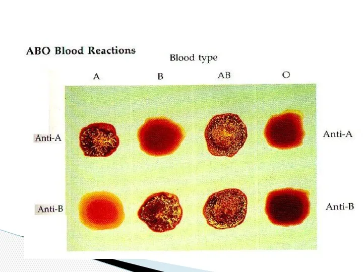 Group AB is called universal recipient , and group O is known as universal donor