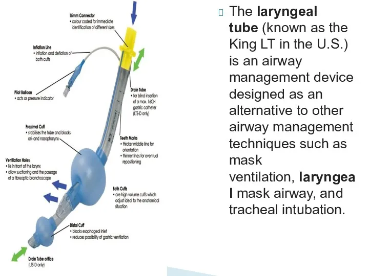 The laryngeal tube (known as the King LT in the