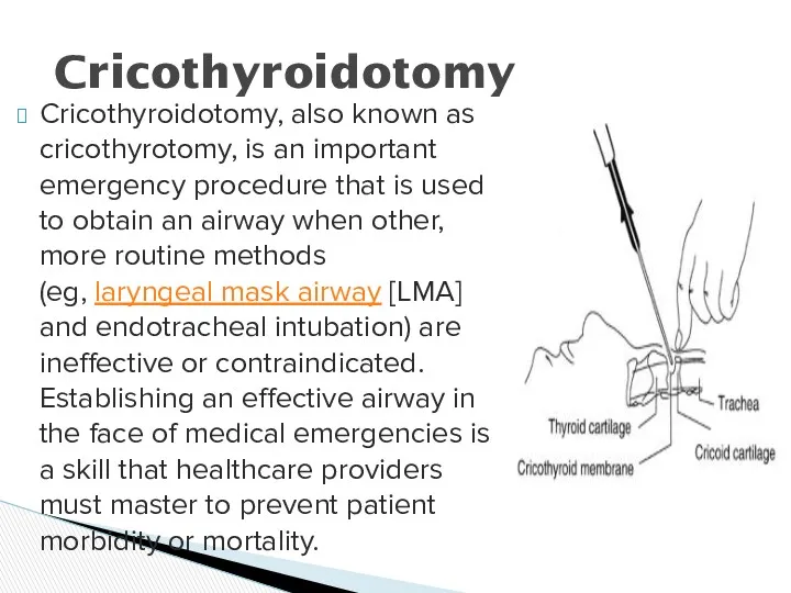 Cricothyroidotomy, also known as cricothyrotomy, is an important emergency procedure