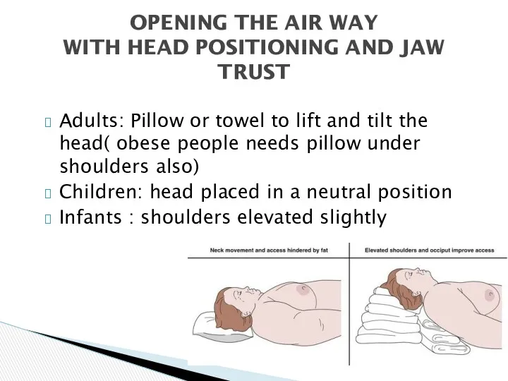 Adults: Pillow or towel to lift and tilt the head(