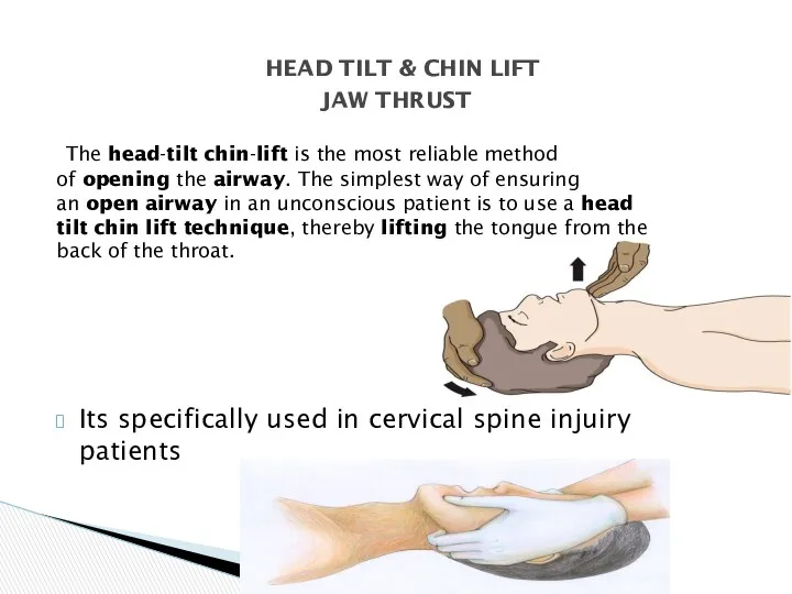 The head-tilt chin-lift is the most reliable method of opening