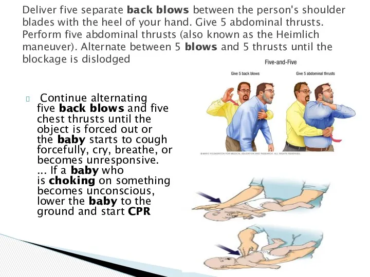 Continue alternating five back blows and five chest thrusts until