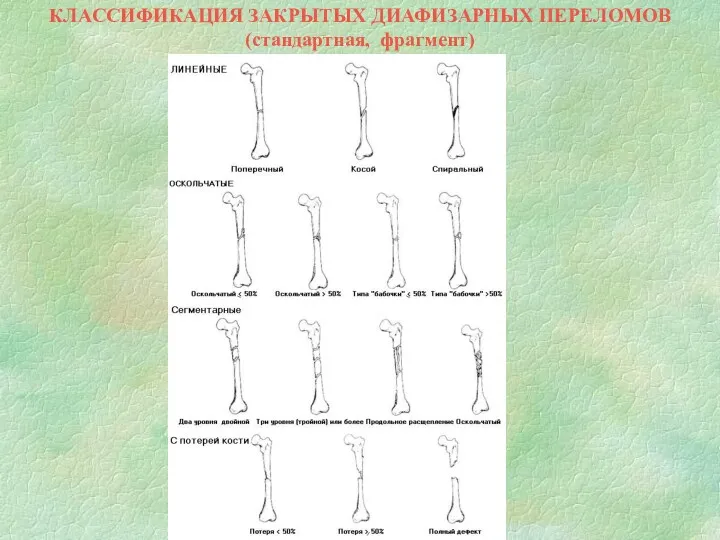 КЛАССИФИКАЦИЯ ЗАКРЫТЫХ ДИАФИЗАРНЫХ ПЕРЕЛОМОВ (стандартная, фрагмент)