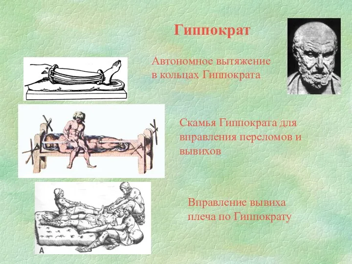 Гиппократ Автономное вытяжение в кольцах Гиппократа Скамья Гиппократа для вправления