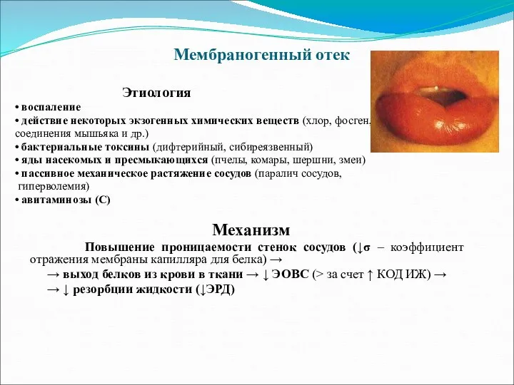 Мембраногенный отек Этиология • воспаление • действие некоторых экзогенных химических