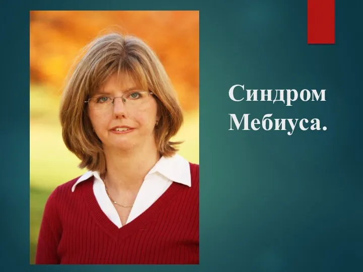 Синдром Мебиуса.