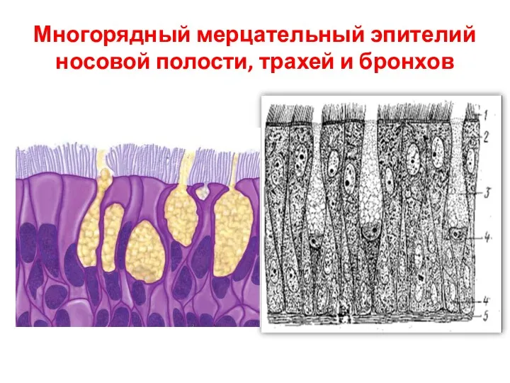 Многорядный мерцательный эпителий носовой полости, трахей и бронхов