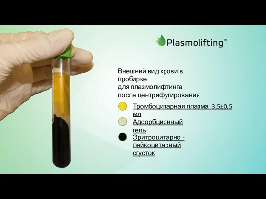 Внешний вид крови в пробирке для плазмолифтинга после центрифугирования Тромбоцитарная плазма 3,5±0,5 мл